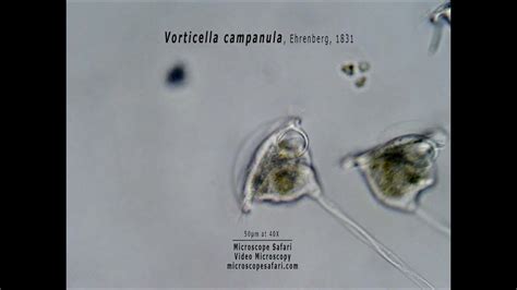   Vorticella! A Tiny Creature With Spiraling Arms That Will Capture Your Heart (and Dinner)!